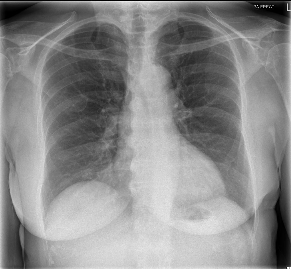 Case 11